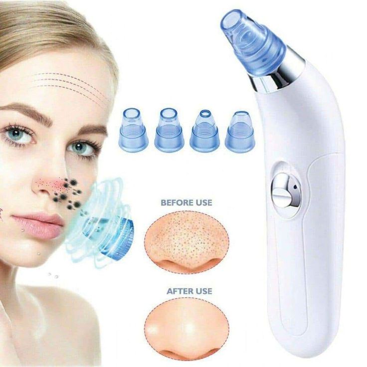 Derma Suction Blackhead Remover