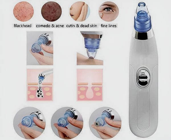 Derma Suction Blackhead Remover