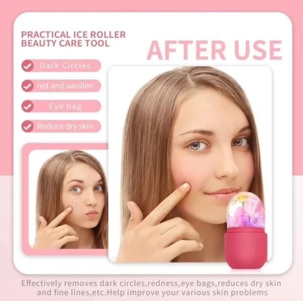 Silicon face ice roller